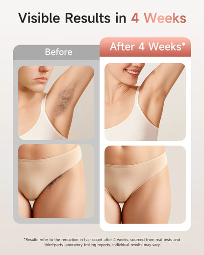 Unlimited Flashes IPL Hair Removal 9 energy levels epiladora laser with Acne treatment for Women’s Body and Bikini Line Home use